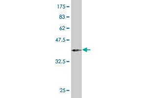 Western Blot detection against Immunogen (37. (PAX2A Antikörper  (AA 194-303))