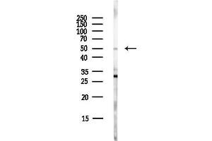 Western blot analysis of lysates from EC304 cells(LPS,4h treatment), using WASH1 Antibody at 1/1000 dilution. (WAS Protein Family Homolog 1 (WASH1) Antikörper)