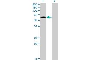 Western Blotting (WB) image for anti-Interleukin-1 Receptor-Associated Kinase 3 (IRAK3) (AA 497-596) antibody (ABIN564872)