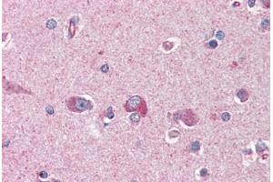 Human Brain, Cortex (formalin-fixed, paraffin-embedded) stained with PAFAH1B1 antibody ABIN364420 at 3. (PAFAH1B1 Antikörper  (AA 397-410))