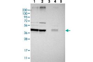 Western blot analysis of Lane 1: RT-4, Lane 2: U-251 MG, Lane 3: Human Plasma, Lane 4: Liver, Lane 5: Tonsil with AUP1 polyclonal antibody .