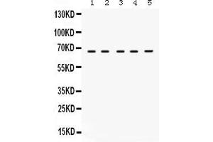 Anti- Munc18-1 Picoband antibody, Western blottingAll lanes: Anti Munc18-1  at 0. (STXBP1 Antikörper  (N-Term))