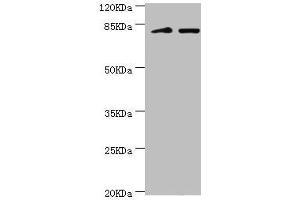 Western blot All lanes: KIF2B antibody at 3. (KIF2B Antikörper  (AA 544-673))