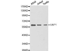 Western blot analysis of extracts of various cell lines, using UAP1 antibody. (UAP1 Antikörper  (AA 1-290))