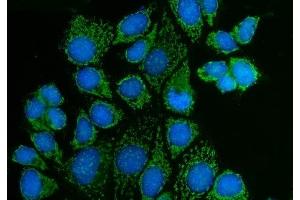 IF analysis of PAK3 using anti-PAK3 antibody (ABIN7599182). (PAK3 Antikörper  (AA 1-263))