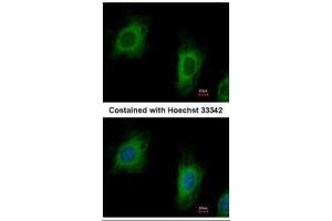 ICC/IF Image Immunofluorescence analysis of paraformaldehyde-fixed HeLa, using TTC1, antibody at 1:500 dilution. (TTC1 Antikörper)