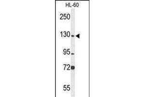 Western blot analysis of MCM2 Antibody (C-term) (ABIN653324 and ABIN2842815) in HL-60 cell line lysates (35 μg/lane). (MCM2 Antikörper  (C-Term))