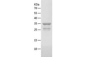 Western Blotting (WB) image for Gastrin-Releasing Peptide (GRP) (AA 24-148) protein (His-IF2DI Tag) (ABIN7124560)