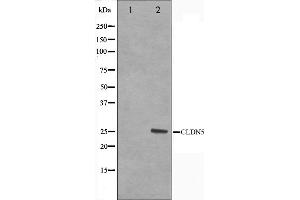 Western blot analysis on A549 cell lysate using Claudin 5 Antibody,The lane on the left is treated with the antigen-specific peptide. (Claudin 5 Antikörper  (C-Term))