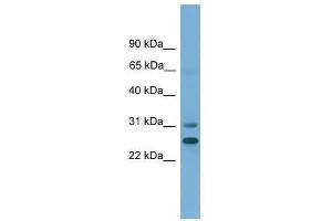Western Blot showing DHRS2 antibody used at a concentration of 1-2 ug/ml to detect its target protein. (DHRS2 Antikörper  (N-Term))