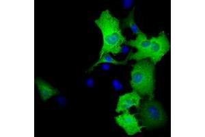Anti-RALBP1 mouse monoclonal antibody (ABIN2453581) immunofluorescent staining of COS7 cells transiently transfected by pCMV6-ENTRY RALBP1 (RC201524). (RALBP1 Antikörper)