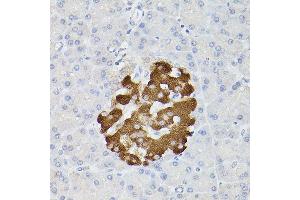 Immunohistochemistry of paraffin-embedded rat pancreatic islet using Insulin Rabbit pAb (ABIN3022884, ABIN3022885, ABIN3022886 and ABIN6219279) at dilution of 1:100 (40x lens). (Insulin Antikörper  (AA 1-110))