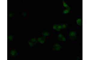 Immunofluorescence staining of HepG2 cells with ABIN7139715 at 1:50, counter-stained with DAPI. (alpha 1 Adrenergic Receptor Antikörper  (AA 6-22))