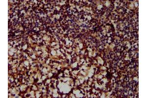 IHC image of ABIN6999591 diluted at 1:300 and staining in paraffin-embedded human tonsil tissue performed on a Leica BondTM system. (MX2 Antikörper  (AA 548-688))