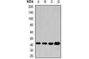 Western blot analysis of PP2C-alpha expression in Hela (A), HepG2 (B), mouse liver (C), rat brain (D) whole cell lysates. (PPM1A Antikörper)