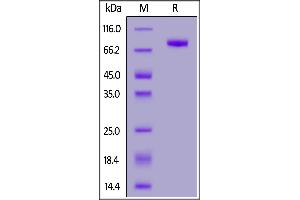 Human LRRC15, His Tag on  under reducing (R) condition. (LRRC15 Protein (AA 22-538) (His tag))