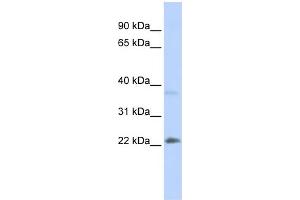 WB Suggested Anti-SRY Antibody Titration:  0.