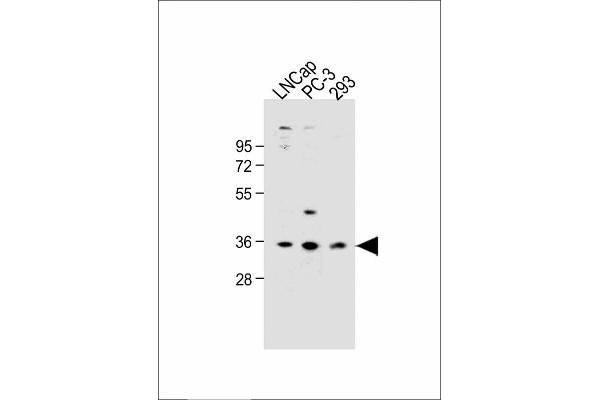 OR6C3 anticorps  (AA 203-238)