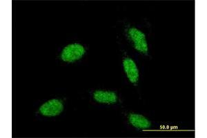 Immunofluorescence (IF) image for anti-Retina and Anterior Neural Fold Homeobox (RAX) (AA 104-206) antibody (ABIN526241)