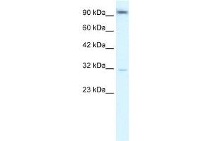 WB Suggested Anti-AHR Antibody Titration:  2. (Aryl Hydrocarbon Receptor Antikörper  (N-Term))