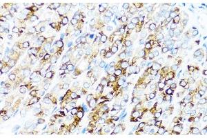 Immunohistochemistry of paraffin-embedded Mouse stomach using SERPINA7 Polyclonal Antibody at dilution of 1:100 (40x lens). (SERPINA7 Antikörper)