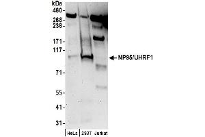 Western Blotting (WB) image for anti-Ubiquitin-Like, Containing PHD and RING Finger Domains, 1 (UHRF1) (AA 275-325) antibody (ABIN7453638)