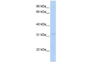 MTCH2 antibody used at 1 ug/ml to detect target protein. (MTCH2 Antikörper)