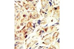 Immunohistochemistry (Paraffin-embedded Sections) (IHC (p)) image for anti-Insulin-Like Growth Factor 1 Receptor (IGF1R) (N-Term) antibody (ABIN359877)