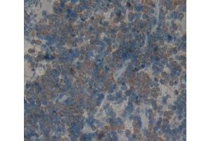 Immunohistochemistry (IHC) image for anti-Killer Cell Lectin-Like Receptor Subfamily K, Member 1 (KLRK1) (AA 75-215) antibody (ABIN7444361)