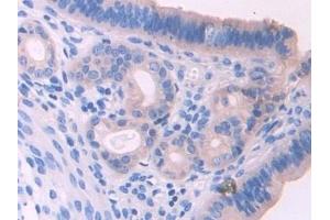 Detection of UMODL1 in Mouse Uterus Tissue using Polyclonal Antibody to Uromodulin Like Protein 1 (UMODL1) (UMODL1 Antikörper  (AA 34-306))