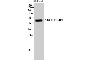 Western Blotting (WB) image for anti-Mitogen-Activated Protein Kinase Kinase 1 (MAP2K1) (pThr386) antibody (ABIN5959683) (MEK1 Antikörper  (pThr386))