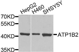 Western blot analysis of extracts of various cell lines, using ATP1B2 antibody. (ATP1B2 Antikörper  (AA 68-290))