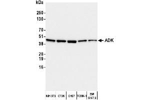 Western Blotting (WB) image for anti-Adenosine Kinase (ADK) (AA 312-362) antibody (ABIN7449946)