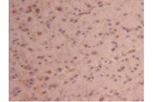 IHC-P analysis of Mouse Brain Tissue, with DAB staining. (CPB2 Antikörper  (AA 187-327))