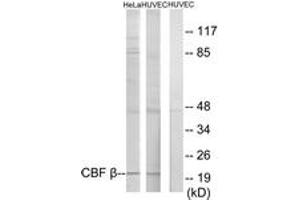 Western blot analysis of extracts from HuvEc/HeLa cells, using CBF beta Antibody. (CBFB Antikörper  (AA 11-60))