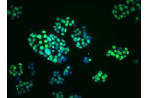 Immunoflourescent staining of PDX-1 in mouse pancreatic tumor (insulinoma) cells. (PDX1 Antikörper)