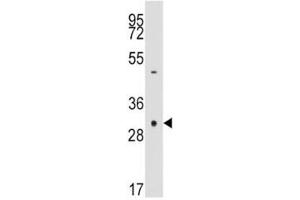 Western Blotting (WB) image for anti-Caspase 3 (CASP3) (AA 60-90) antibody (ABIN3030306)