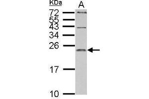 Western Blotting (WB) image for anti-Interleukin 1 Receptor Antagonist (IL1RN) antibody (ABIN2856394)
