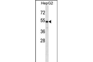CHST9 anticorps  (N-Term)