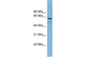 WB Suggested Anti-C7orf43 Antibody Titration: 0. (C7orf43 Antikörper  (Middle Region))