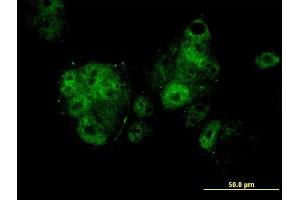 Immunofluorescence of monoclonal antibody to MEF2A on MCF-7 cell. (MEF2A Antikörper  (AA 71-170))