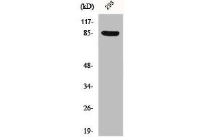 Western Blot analysis of 293 cells using Phospho-Cortactin (Y466) Polyclonal Antibody (Cortactin Antikörper  (pTyr466))