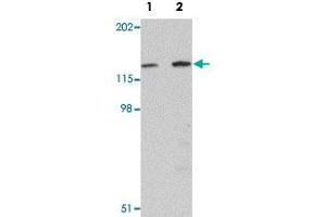 Western blot analysis of mouse skeletal muscle tissue with MYBPC2 polyclonal antibody  at (Lane 1) 1 and (Lane 2) 2 ug/mL dilution. (MYBPC2 Antikörper  (C-Term))