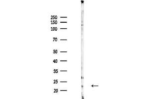 anti-Sorting Nexin 12 (SNX12) antibody
