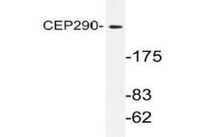 Western blot (WB) analysis of CEP290 antibody in extracts from K562 cells. (CEP290 Antikörper)