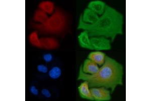 ABIN6257299 and ABIN6275373 staining Hela cells by IF/ICC. (KCNK17 Antikörper  (C-Term))