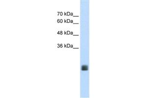 Western Blotting (WB) image for anti-Transmembrane Protein 178A (TMEM178A) antibody (ABIN2462646) (TMEM178 Antikörper)