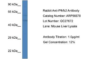 Western Blotting (WB) image for anti-6-phosphofructo-2-Kinase/fructose-2,6-Biphosphatase 2 (PFKFB2) (C-Term) antibody (ABIN2786834) (PFKFB2 Antikörper  (C-Term))