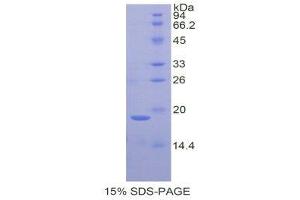 SDS-PAGE (SDS) image for Galectin 7 (LGALS7) (AA 1-128) protein (His tag) (ABIN1079628) (LGALS7 Protein (AA 1-128) (His tag))