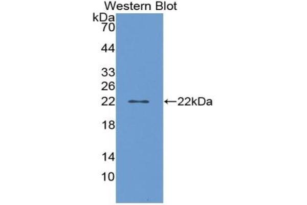 PTGDS Antikörper  (AA 32-190)